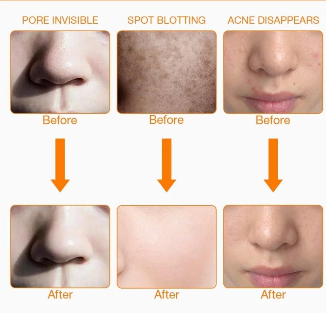 Máscara Facial Estética